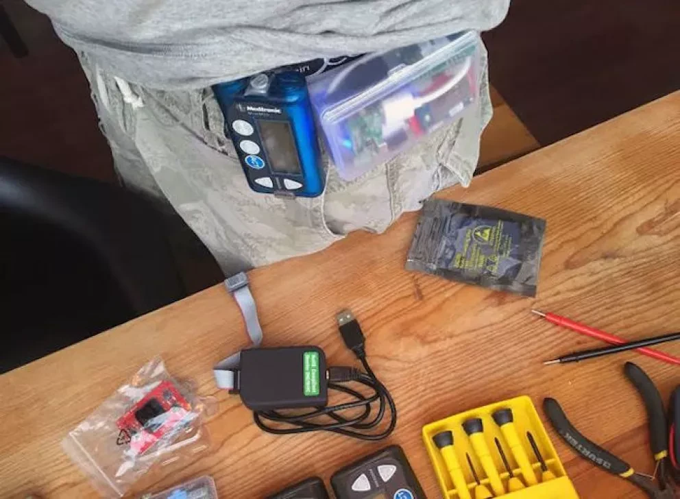 Ingeniero mexicano se fabrica un páncreas para tratar su diabetes