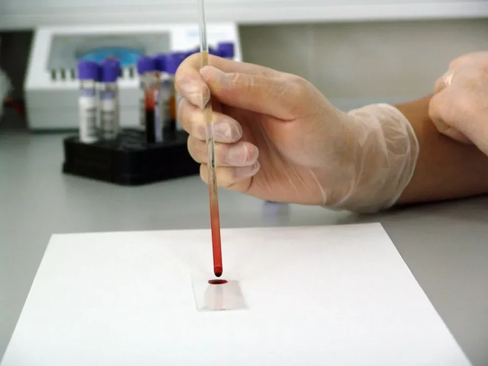 Salud Digna: ¿Cuáles son los costos de los estudios de laboratorio?
