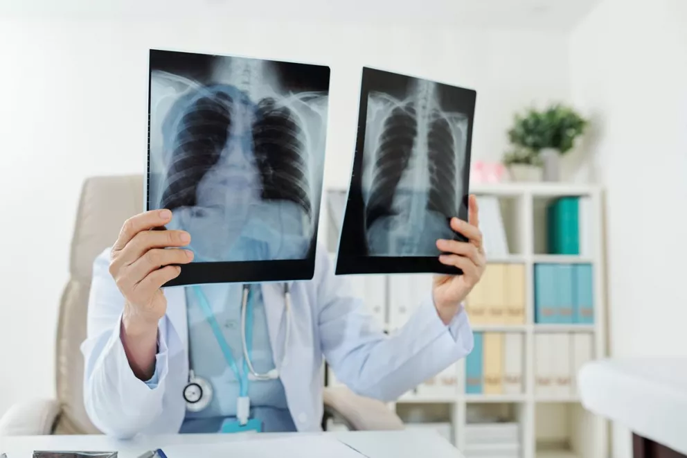 Pulmones. Foto: iStock/Cortesía