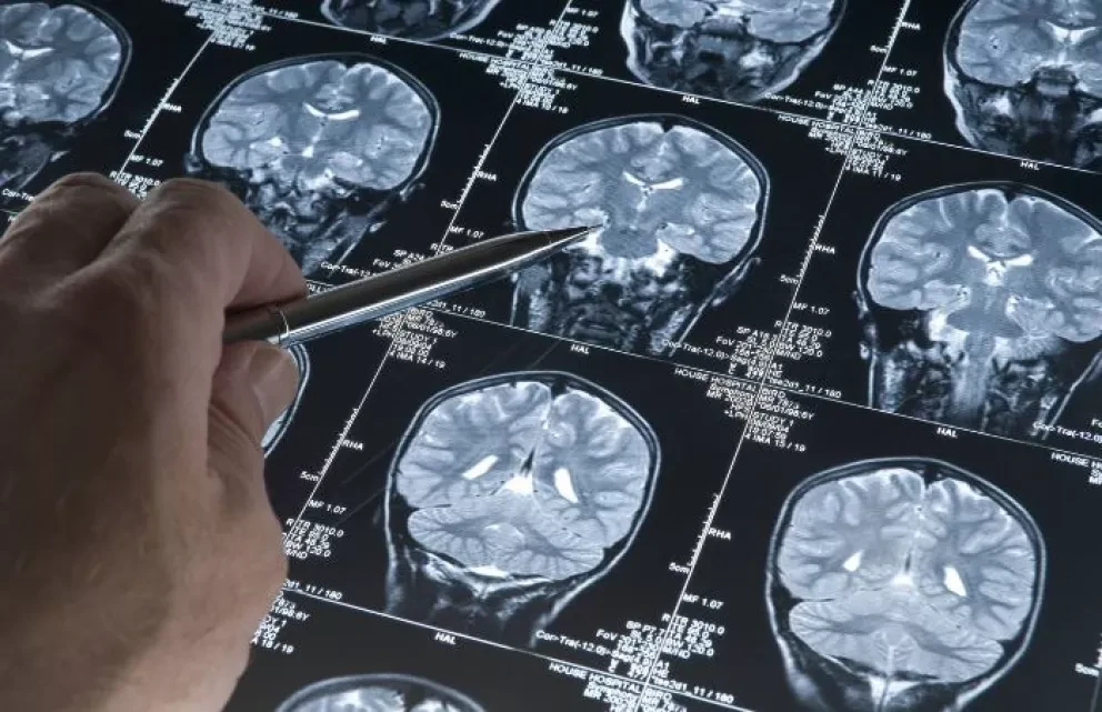 Crean sensor capaz de detectar signos de Alzheimer hasta 17 años antes