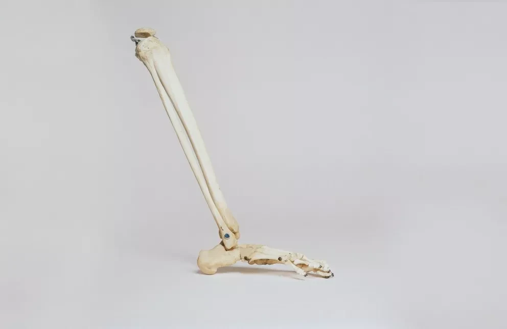 ¿Qué es la osteoporosis? Causas y recomendaciones para esta enfermedad. Foto. Nino Liverani