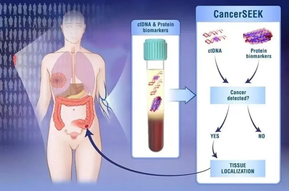 Desarrollan análisis universal para detectar el cáncer
