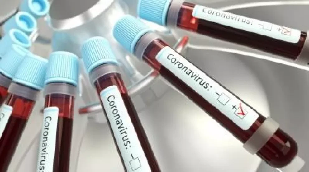 Conoce la vulnerabilidad al Covid-19 según el tipo de sangre