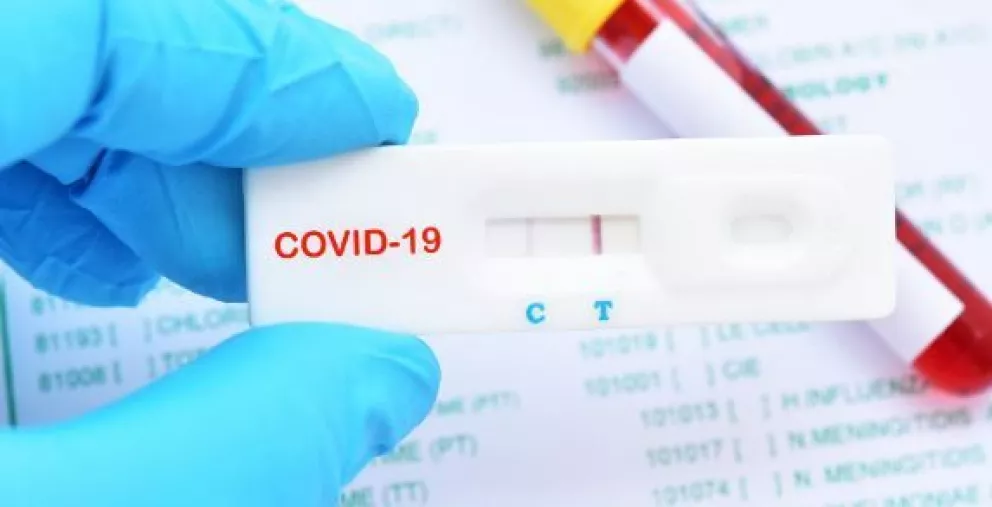 Test de detección de Covid-19, ¿los sabes identificar?