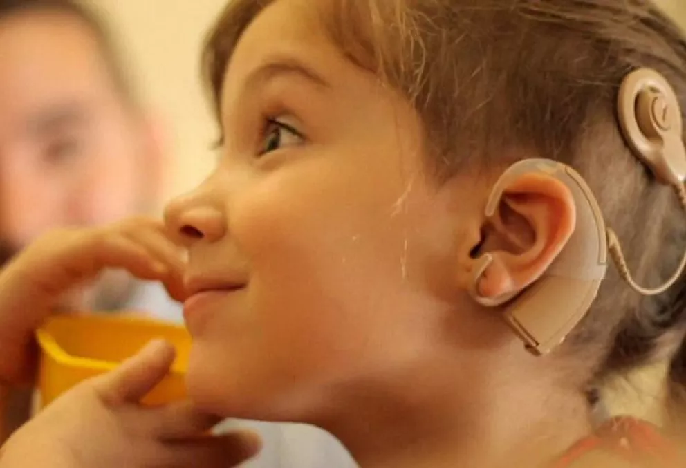 Campaña de implantes de oído para niños gratis