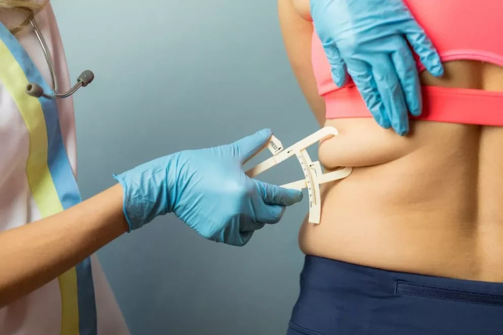 Obesidad; un factor determinante en casos de Covid