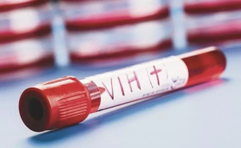 Con células madres eliminan el VIH en seis pacientes infectados