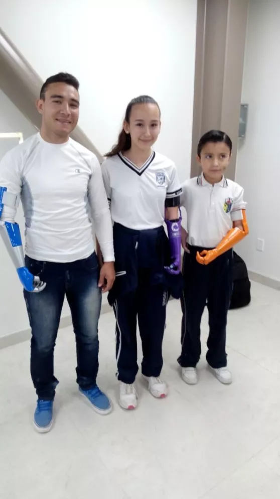 Tres miembros de una familia reciben brazo artificial