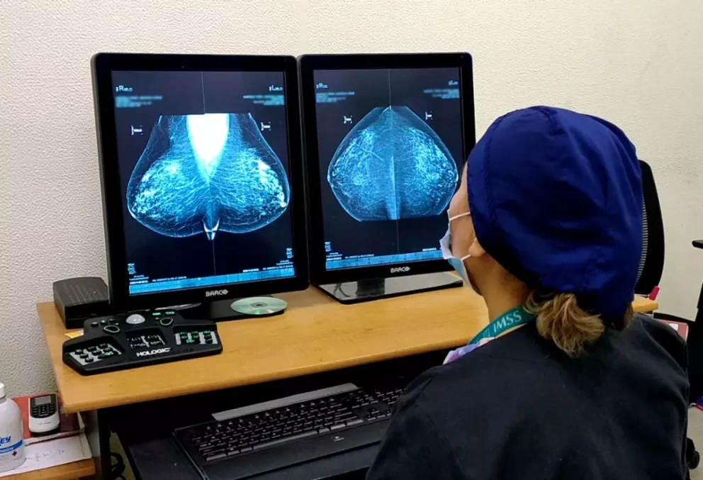 Mujeres de Mazatlán nuevamente podrán realizarse la mastrografía