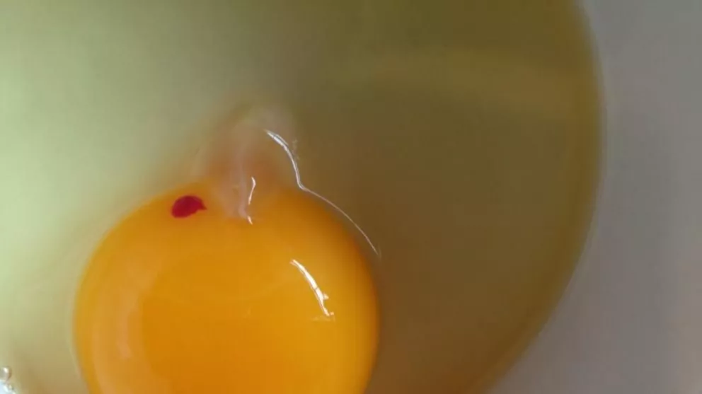 Es seguro comer las manchas rojas del huevo