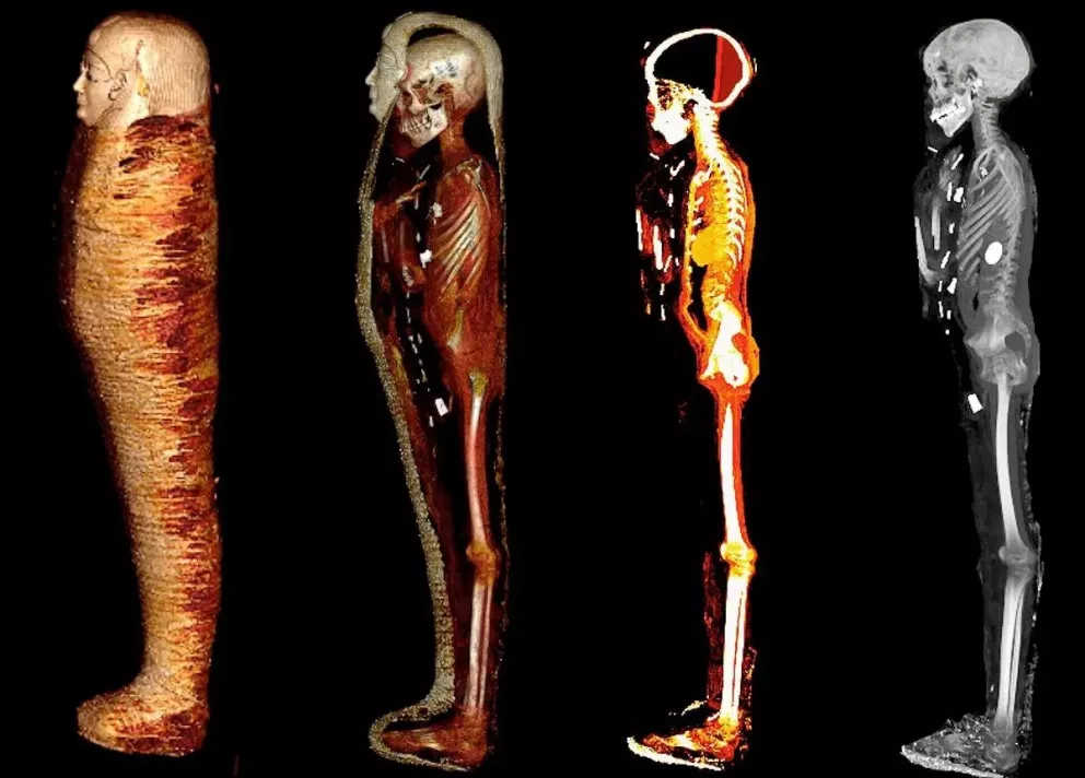 La momia del niño oro que estaba protegido con 49 amuletos de oro