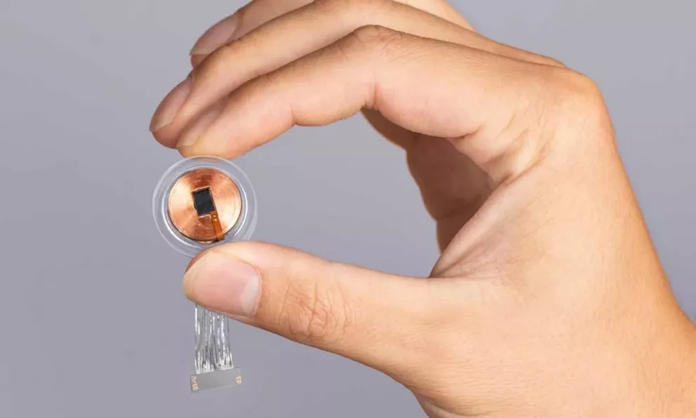 Neuralink dijo que la autorización de la Administración estadounidense de Medicamentos y Alimentos (US Food and Drug Administration, FDA) para su primer estudio clínico en humanos.