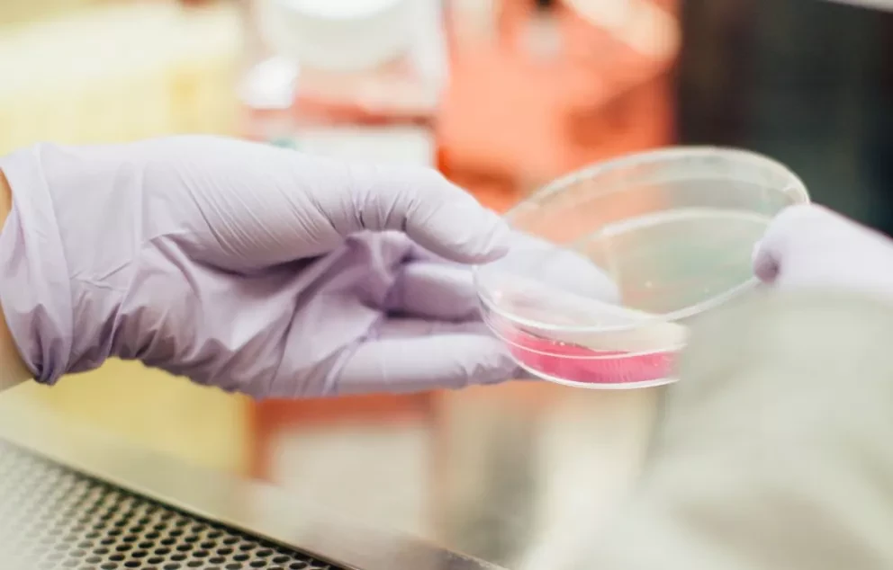 BBVA y Salud Digna ofrecerán más de medio millón de pruebas de papanicolaou y detección de VPH gratis. Foto: Drew Hays