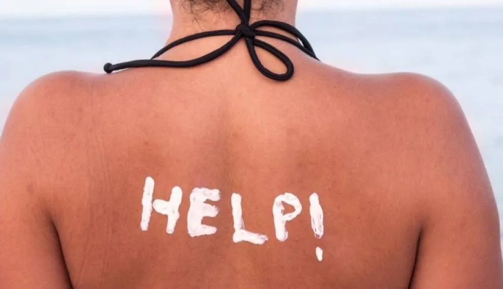 ¿Dermatitis atópica? 3 tips para prepararte para la playa
