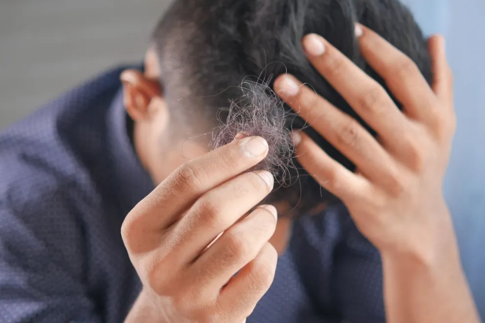 Regresa a Costco el shampoo Revita para evitar la caída de cabello.