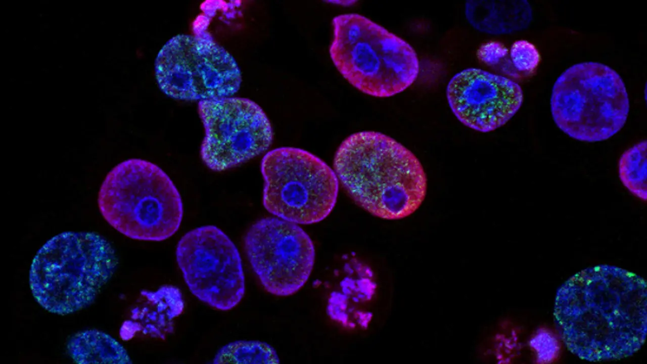 Existen distintos tipos de cáncer| Imagen National Cancer Institute