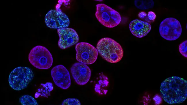 Existen distintos tipos de cáncer| Imagen National Cancer Institute