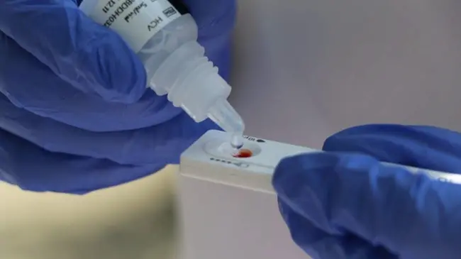 Hospital General de México invita a la población a acudir a realizarse la prueba de detección de hepatitis C.