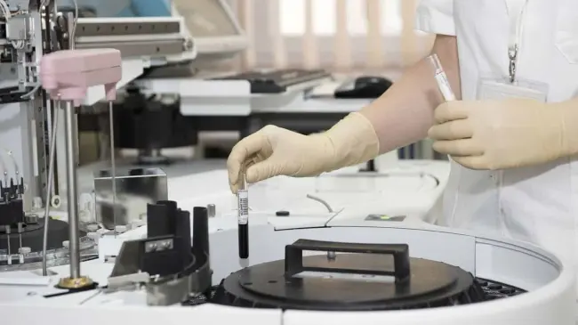 Costo de la prueba de química sanguínea en Salud Digna en 2024. Foto: Pixabay