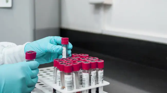 Pruebas gratis para la detección de hepatitis C, VIH y Sífilis en Mazatlán.