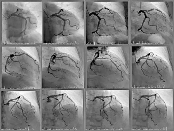 Crean en la UAS un sistema de inteligencia artificial que identifica enfermedades cardíacas Crean en la UAS un sistema de inteligencia artificial que identifica enfermedades cardíacas