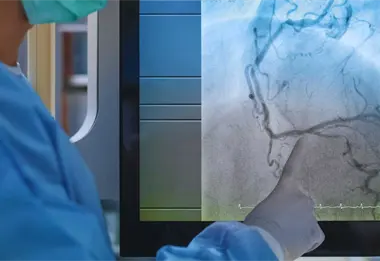 Investigador de la UAS desarrolla tecnología con IA para detectar infartos antes de que ocurran