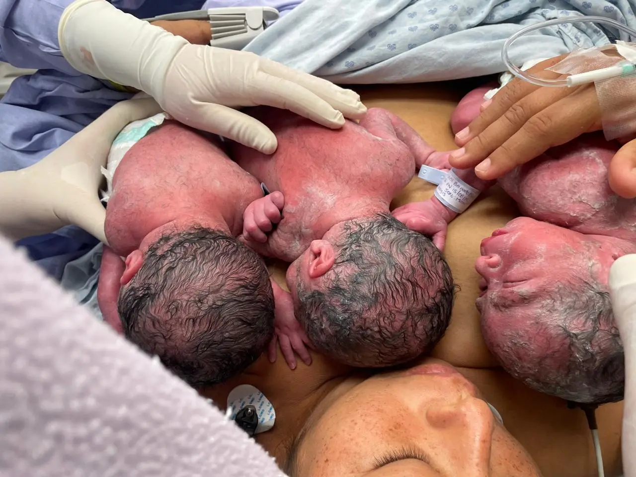 Nacimiento de trillizos en Tabasco. Los tres bebés se encuentran en perfectas condiciones.