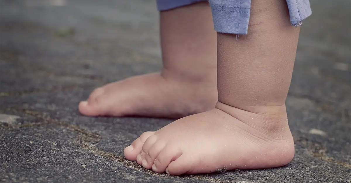 Hay más niños con obesidad que con bajo peso, dice Unicef