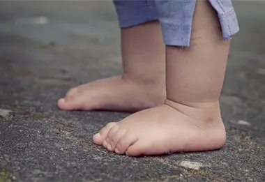 Hay más niños con obesidad que con bajo peso, dice Unicef