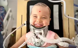 El milagro de Oliver: el niño que sobrevivió a una cirugía imposible y desafió a la medicina