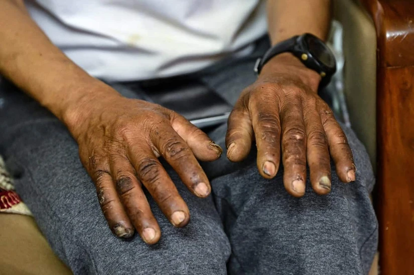 Dawa Sherpa, el montañista nepalí que sobrevivió una semana en el Everest, fue hallado cerca del campamento base tras permanecer tres días atrapado en una grieta a más de 8,000 metros de altitud. FOTO:AFP