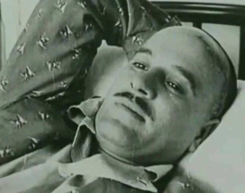 Pedro Infante cuando se recuperaba tras ponerle una placa de platino en la cabeza. Foto: Cortesía