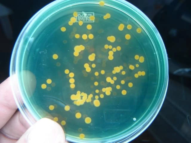 Adrián González Castillo destaca la importancia de la taxonomía bacteriana y ha participado en la identificación de nuevas especies de Vibrio presentes en ambientes acuáticos y cultivos de ostión.