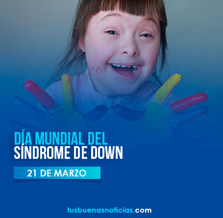 síndrome de down